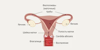 Заболевание вульвы и половых губ