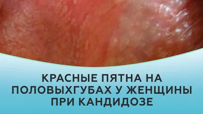 Пластика половых губ: до и после | Пластический хирург Листратенков К.В.