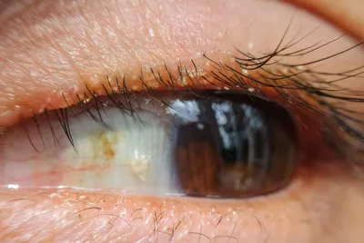 Причины врожденных болезней глаз - Офтальмологические клиники «Эксимер»  (Одесса) - диагностика и лечение заболеваний глаз у взрослых и детей