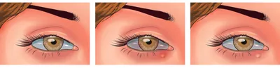 Почему дергается глаз? Какие бывают причины глазного нервного тика и как  его лечить: Здоровье: Наука и техника: Lenta.ru