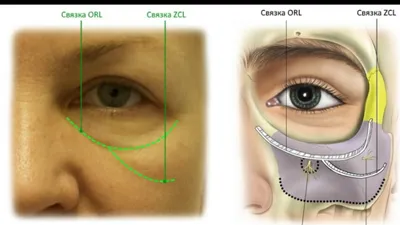 Как лечить ячмень на глазах ребенка 👀 Информационный портал Детское зрение