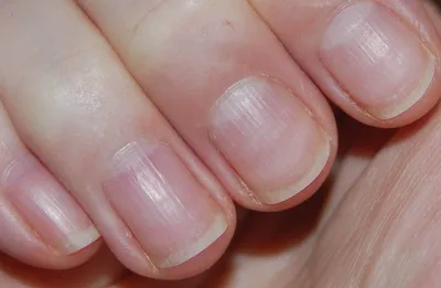 Вебинар «Болезни ногтей на руках и ногах, болезни кожи стоп» | Онлайн курс  по маникюру в #INCITY#