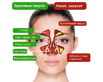 Иллюстрация 2 из 20 для Болезни уха, горла и носа - Бербом, Кашке, Навка |  Лабиринт - книги.