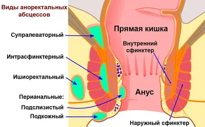 Боль в заднем проходе - причины появления, при каких заболеваниях  возникает, диагностика и способы лечения