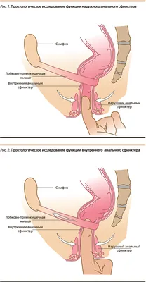 Лечение причин появления крови из ануса в СПб - цены, отзывы