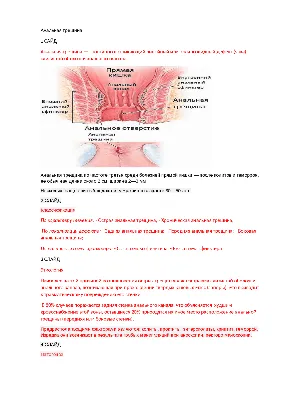 Анальная боль и зуд в заднем проходе: что делать — блог медицинского центра  ОН Клиник