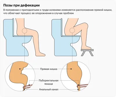 Выпадение прямой кишки: симптомы, диагностика и лечение в клинике Universum  Clinic