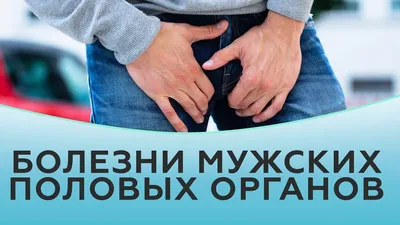 Папилломы на половых органах: причины и лечение