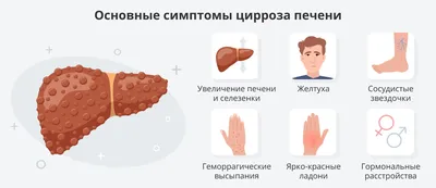 Симптомы больной печени ▻ Могут ли ноги рассказать о заболеваниях печени? -  YouTube