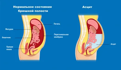 БОЛЬНАЯ ПЕЧЕНЬ - СИМПТОМЫ НА КОЖЕ | Академия врачей UNIPROF | Дзен