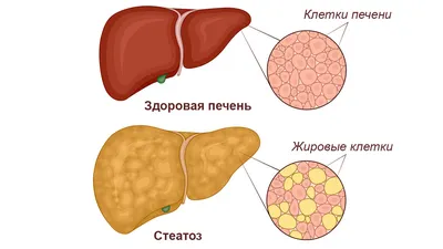 Сепсис - причины появления, симптомы и признаки заболевания, диагностика и  способы лечения, прогноз и последствия