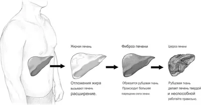 Как внутренние заболевания проявляются на коже | РБК Стиль