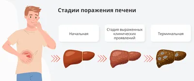 Поражение печени: виды и причины, симптомы и лечение