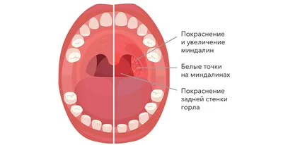 Девушка чувствует боль в горле Фон И картинка для бесплатной загрузки -  Pngtree