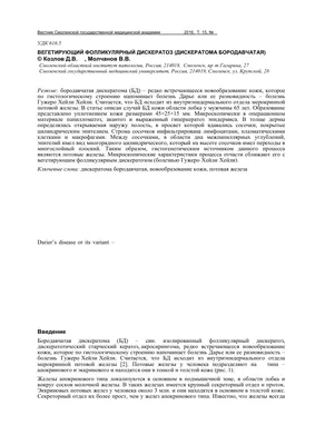 Что такое базалиома и насколько она опасна - Лайфхакер