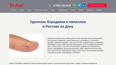 Удаление бородавок, папиллом в Ростове-на-Дону - клиника Doctor-Prof