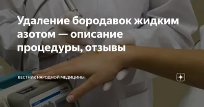 Удаление бородавок жидким азотом — описание процедуры, отзывы | Вестник  Народной Медицины | Дзен