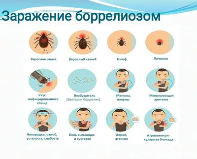 Клещевой боррелиоз (Болезнь Лайма) - Судебная медицина от Forens.ru