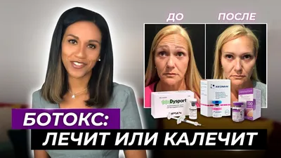 beautyline.krd - Можно ли колоть ботокс перед отпуском? 😉👇 Ставим ❤ и  читаем дальше🤗 👌Можно и нужно! Это и профилактика возникновения новых  морщин, и коррекция уже имеющихся, чтобы они не стали глубже.