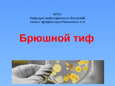 Брюшной тиф – что это за болезнь, 💉 лечение, симптомы и 🔬 диагностика на  МЕД Zoon