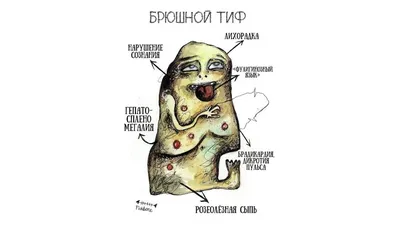 Брюшной тиф - Инфекционные болезни - Справочник MSD Профессиональная версия