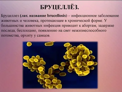 Бруцеллез у человека: симптомы, возбудитель, пути передачи, формы, лечение,  профилактика в домашних условиях