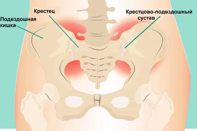 Бруцеллез - причины появления, симптомы заболевания, диагностика и способы  лечения