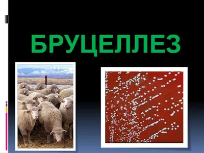 Бруцеллез – симптомы, причины, диагностика и лечение болезни | «Будь Здоров»