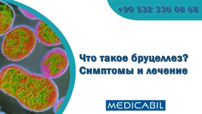 Что такое бруцеллез ❓ определение, симптомы, признаки, диагностика, что за  болезнь