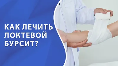 Почему формируется бурсит стопы и как его лечить