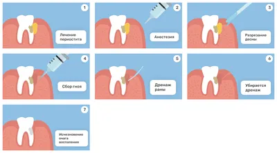 Что такое свищ на десне? | Стоматология \"Лана\" Пермь | Дзен