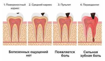 Почему возникает свищ на десне и как его лечить – полезная информация,  стоматология ЛидерСтом в Москве