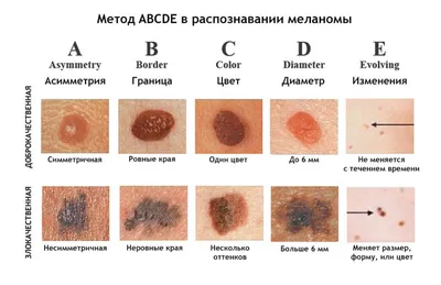 Белые полоски на ногтях рук – причины, что означают | Лечение белых  продольных / поперечных полос в Клинике подологии Полёт