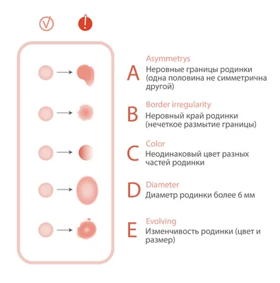 https://anabelle.com.ua/dermatoscopy/