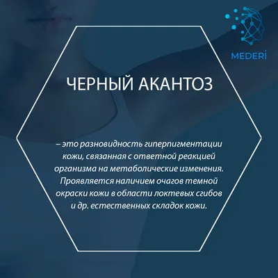 Черный акантоз у человека - Medside.ru