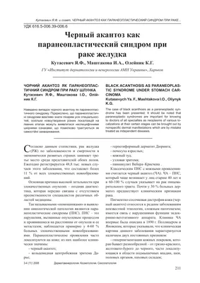 Создать мем \"шея, лимфоузлы на шее, черный акантоз на шее фото\" - Картинки  - Meme-arsenal.com