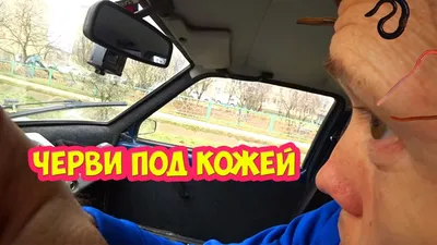 Черви под кожей фото