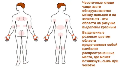 Кожа как индикатор. Почему после купания в Оби появляются пятна и чесотка?  - YouTube