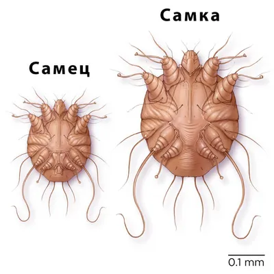 Чесоточный клещ: найти и обезвредить! - Ульяновский областной центр  профессиональной паталогии им. Максимчука В.М.
