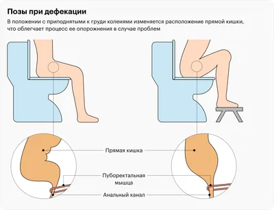 Почему нельзя долго сидеть на унитазе