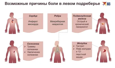 Что находится под левым ребром фото