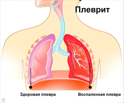 Почему болит левый бок под ребрами | причины болей в левом боку