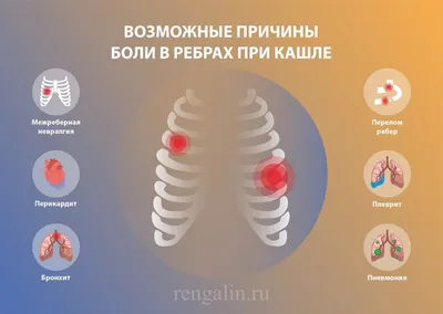 Болят ребра при кашле: почему при кашле болит правый или левый бок под  ребрами