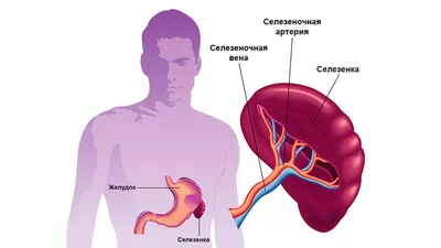 Рентгенография органов грудной клетки - Системный подход