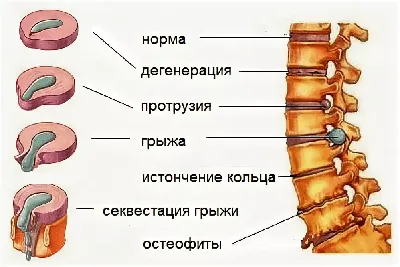 Колющая боль в области сердца: причины колющей боли в области груди, из-за  чего может колоть сердце