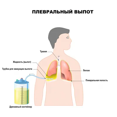 Селезенка: где находится, где болит, функции, строение