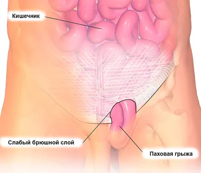 Спазмы под ребрами: причины, лечение и локализация