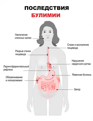 Булимия - причины появления, симптомы заболевания, диагностика и способы  лечения