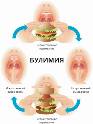 Лечение булимии в центре \"ДоброЗдрав\" в Симферополе с гарантией!