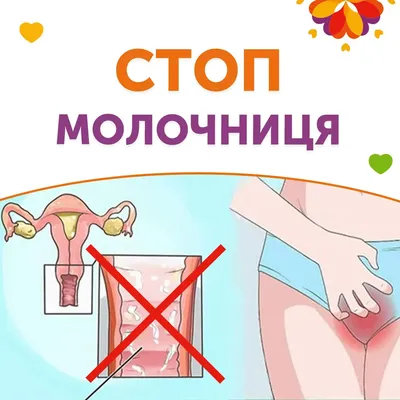 Что такое молочница фото